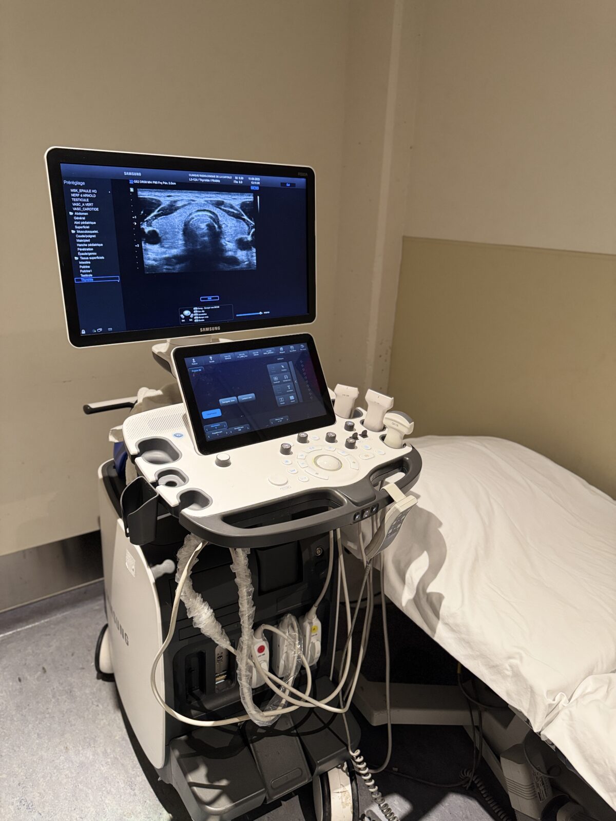 Echographie musculo-squelettique